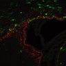 Thumbnail for dataset SuppFig4a_SVZ4_20z