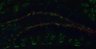 Thumbnail for dataset SuppFig4b_DG5_CtsB_10z