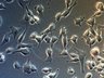 Thumbnail for dataset ActbKO1_brightfield