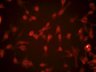 Thumbnail for dataset ActbKO1_MkI1