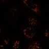 Thumbnail for dataset FigureS7_TMRE_before