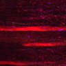 Thumbnail for dataset Fig5_myogenicCell_CDK1_2i_N3_lapse6
