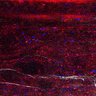 Thumbnail for dataset Fig5_myogenicCell_CDK1i_N1_lapse3