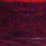 Thumbnail for Fig5_myogenicCell_CDK1i_N1_lapse5