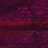 Thumbnail for dataset Fig5_myogenicCell_CDK1i_N2_lapse2