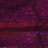 Thumbnail for dataset Fig5_myogenicCell_CDK1i_N2_lapse5