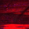 Thumbnail for dataset Fig5_myogenicCell_CDK4_6i_N1_lapse3