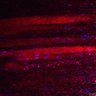 Thumbnail for dataset Fig5_myogenicCell_CDK4_6i_N2_lapse4