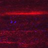 Thumbnail for dataset Fig5_myogenicCell_CDK4_6i_N3_lapse2