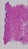 Thumbnail for dataset Fig1f_HE_humanskin