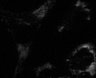 Thumbnail for dataset Fig5_S3_Raman_imaging_VA-13cell_12h