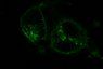 Thumbnail for dataset Fig6F_A2BR_SFN_180min