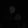 Thumbnail for fig2C_PhyB-PIF6_0010