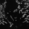 Thumbnail for dataset Fig2A_STED_mitochondria