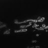 Thumbnail for dataset Fig2B_STED_mitochondria_after