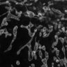 Thumbnail for dataset Fig3_STED_mitochondria_inner_outer