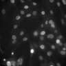 Thumbnail for dataset Figure2D_MC-38_ISRE_IFN-v-