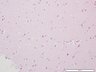 Thumbnail for dataset humanbrain_d5