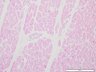Thumbnail for dataset humanheart_d0