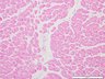 Thumbnail for dataset humanheart_d3
