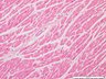 Thumbnail for dataset humanheart_d5
