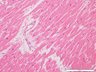 Thumbnail for dataset humanheart_d8
