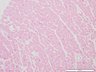 Thumbnail for dataset humanheart_d16