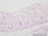 Thumbnail for dataset humanintestine_d0