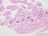 Thumbnail for dataset humanintestine_d16