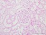 Thumbnail for dataset humankidney_d0