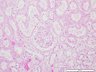 Thumbnail for dataset humankidney_d2