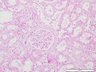 Thumbnail for dataset humankidney_d3