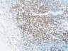 Thumbnail for dataset humanLN_CD3_d7