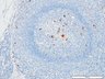 Thumbnail for dataset humanLN_CD68_d0