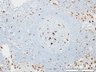 Thumbnail for dataset humanLN_CD68_d4
