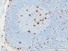 Thumbnail for dataset humanLN_CD68_d7