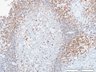 Thumbnail for dataset humanLN_CD79a_d0