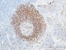 Thumbnail for dataset humanLN_CD79a_d4