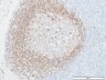 Thumbnail for dataset humanLN_CD79a_d7