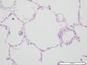 Thumbnail for dataset humanlung_d0