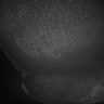Thumbnail for dataset Fig5_Whole_brain_imaging37_20180411_02615