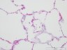 Thumbnail for dataset humanlung_d3