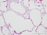 Thumbnail for dataset humanlung_d4