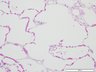 Thumbnail for dataset humanlung_d7