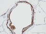 Thumbnail for dataset humanlung_d0_aSMA