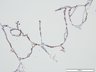 Thumbnail for humanlung_d0_Cytokeratin