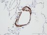 Thumbnail for dataset humanlung_d4_aSMA