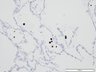 Thumbnail for dataset humanlung_d4_CD68