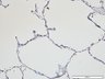 Thumbnail for dataset humanlung_d4_Cytokeratin