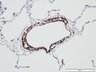 Thumbnail for dataset humanlung_d7_aSMA